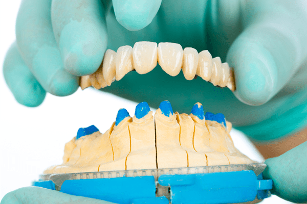 Cemento dentale definitivo per fissaggio di ponti e corone